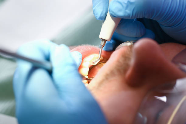 Best Emergency Treatment for Jaw Pain or Injury in University, FL