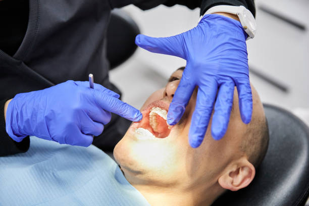 Best Emergency Denture Repair in University, FL
